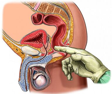 A prostate finger study