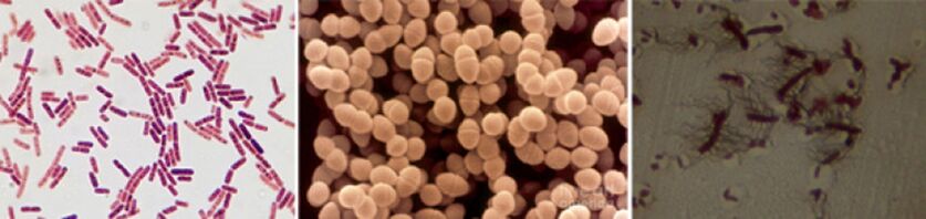 Escherichia Sticks, Enterococcus Fecal and Pro - Chronic bacterial prostatitis pathogens