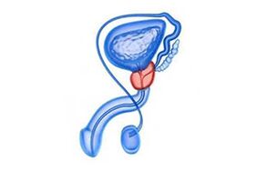 prostate inflammation drawing