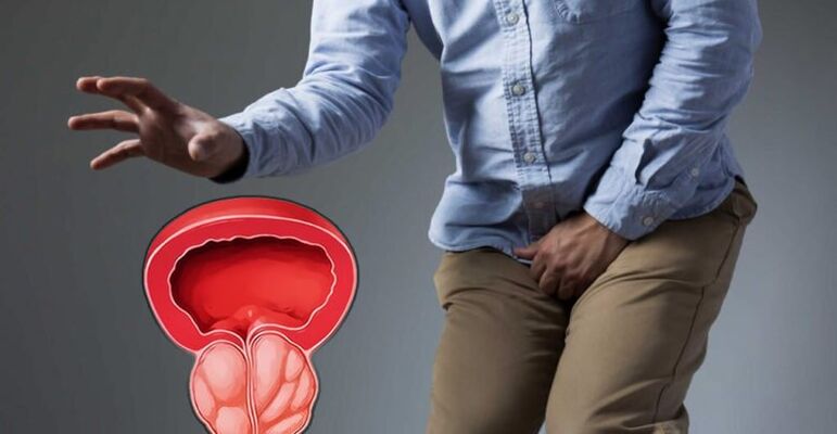 Prevention of prostatitis and prostate adenoma